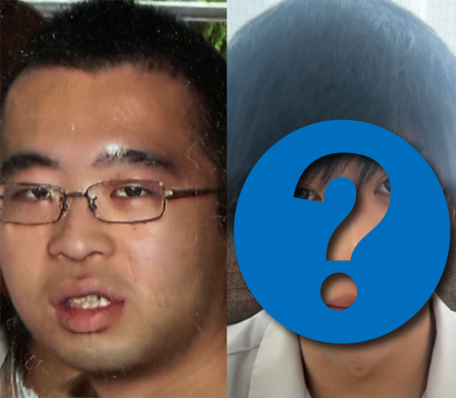 としきさんの整形前と整形後のビフォーアフター