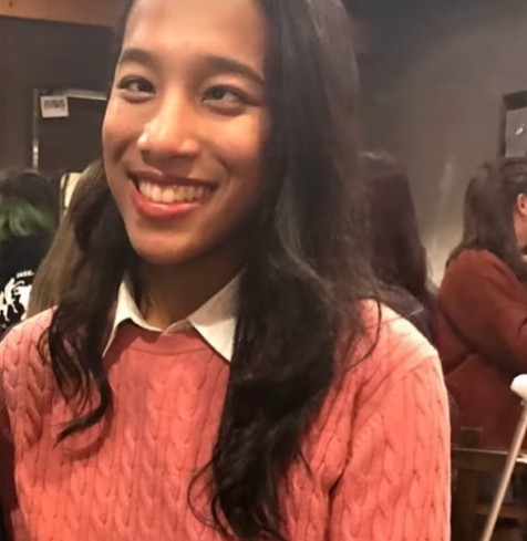 斜視手術前のアリシアさん（@alichel_channelより）