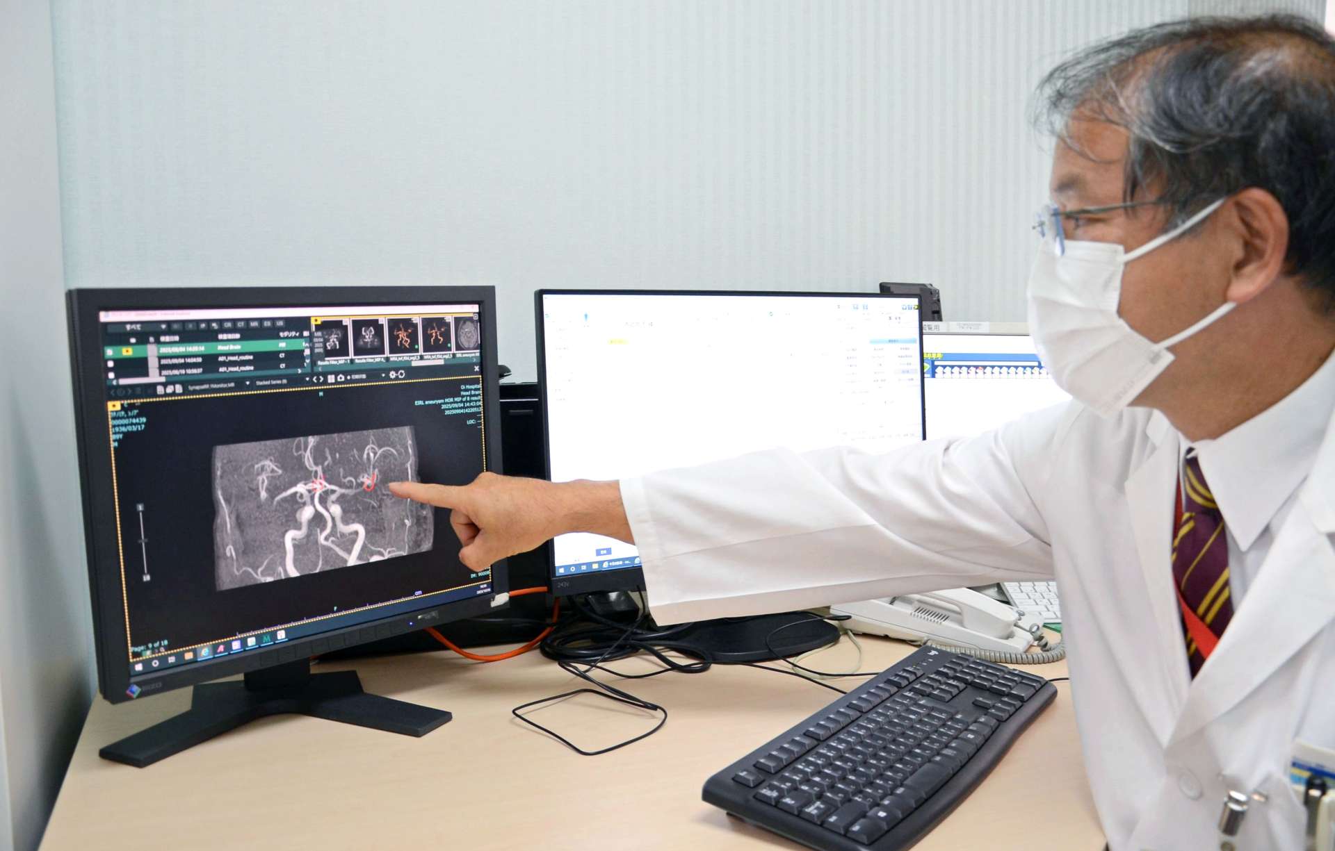 ＡＩで検出した脳動脈瘤が疑われる部分を指す中薗紀幸大井病院長＝６日、姶良市